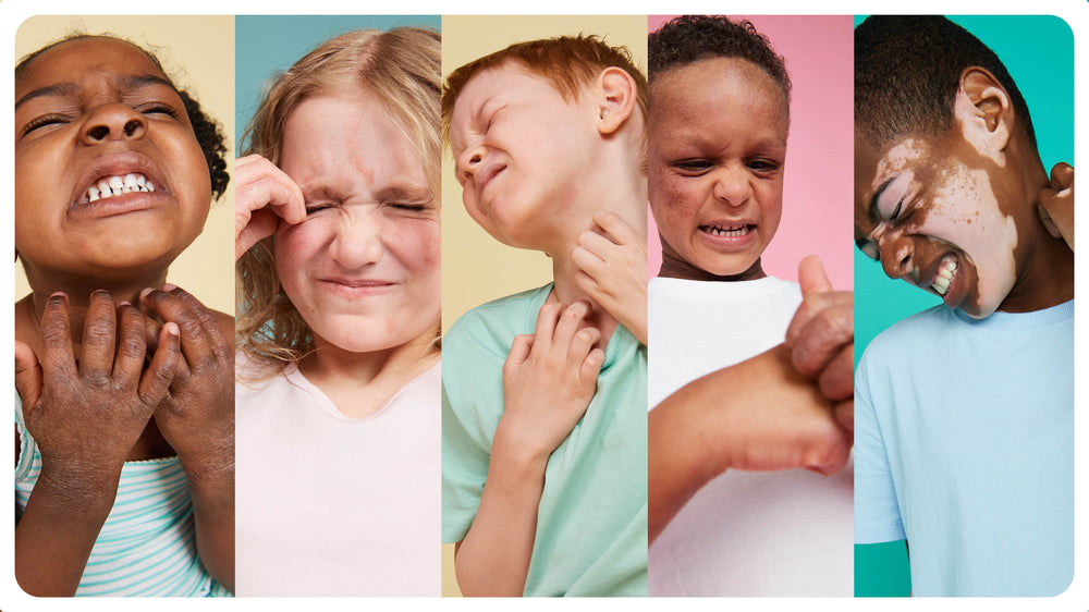 Children dealing with itchy, irritated skin before Cosi Care